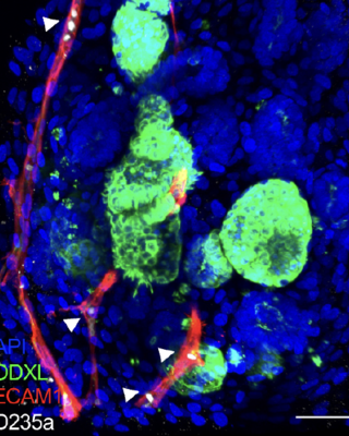 a_perfusable_vascularized_kidney_organoid-on-chip_model.png