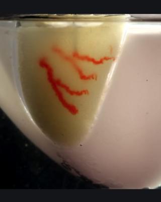 a biomanufactured tissue 