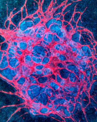 flow-enhanced_vascularization_and_maturation_of_kidney_organoids_in_vitro.jpg