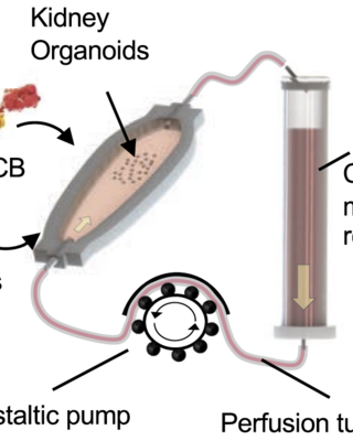 immune-infiltrated_kidney_organoid-on-chip_model_for_assessing_t_cell_bispecific_antibodies.png