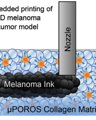 microporogen-structured_collagen_matrices_for_embedded_bioprinting_of_tumor_models_for_immuno-oncology.png