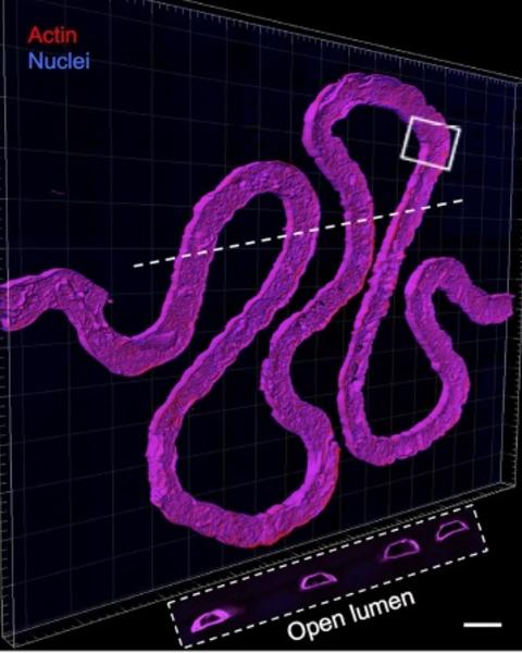 bioprinting_of_3d_convoluted_renal_proximal_tubules_on_perfusable_chips.jpg