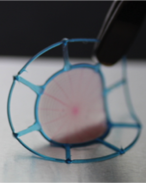design_fabrication_and_in_vitro_testing_of_novel_three-dimensionally_printed_tympanic_membrane_grafts.png