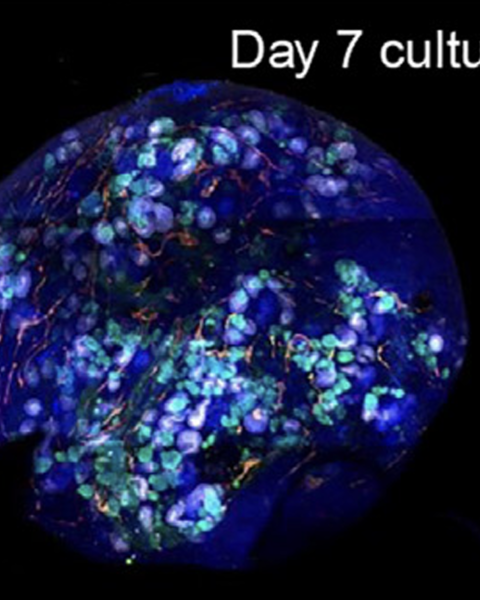 exploring_immune_response_toward_transplanted_human_kidney_tissues_assembled_from_organoid_building_blocks.png