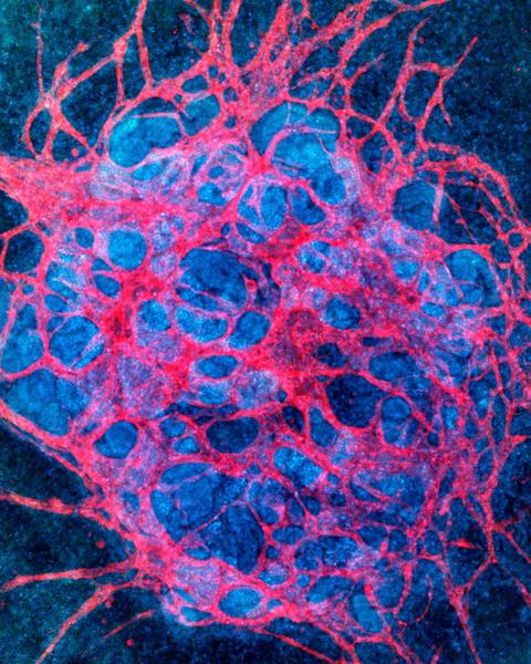 flow-enhanced_vascularization_and_maturation_of_kidney_organoids_in_vitro.jpg
