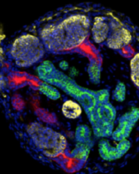 kidney_organoids_-_a_pioneering_model_for_kidney_diseases.png