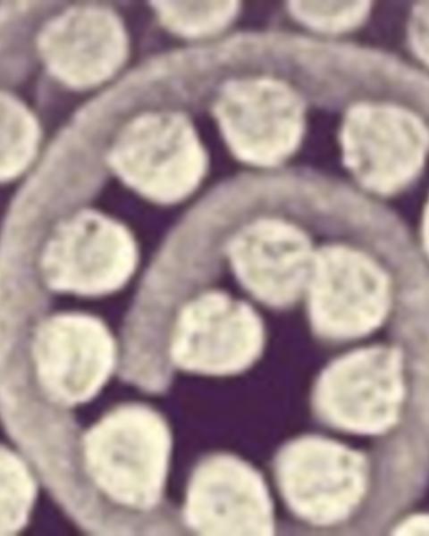 microstructure_and_mechanical_properties_of_reticulated_titanium_scrolls.jpg