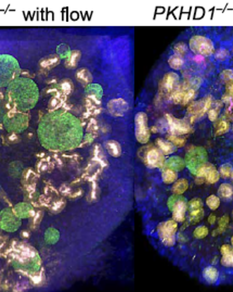 organoid-on-a-chip_model_of_human_arpkd_reveals_mechanosensing_pathomechanisms_for_drug_discovery.png